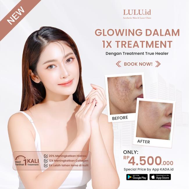 Glow Up Alert! Rahasia Kecantikan Kulitmu di Balik Buah-buahan Segar
